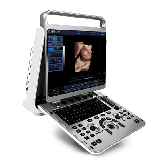 EBit 30 — Portativ ultratovush apparati