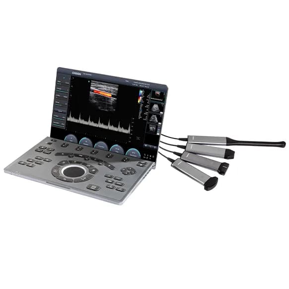 SonoAir 30 — УЗИ-система в формате ноутбука