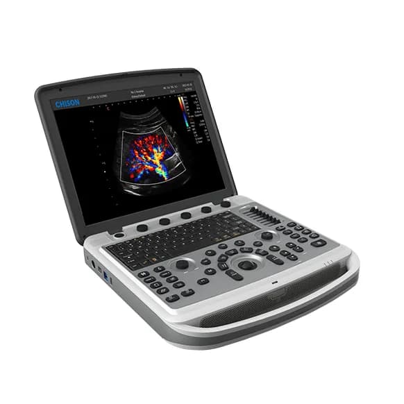 SonoBook 6 — УЗИ-система в формате ноутбука