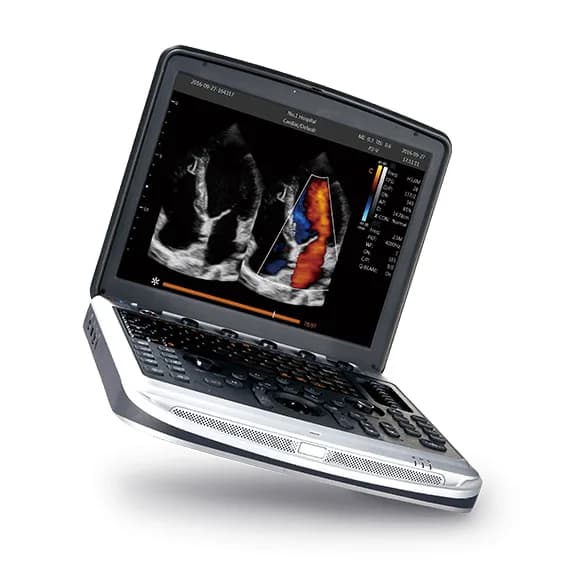 SonoBook 7 — УЗИ-система в формате ноутбука
