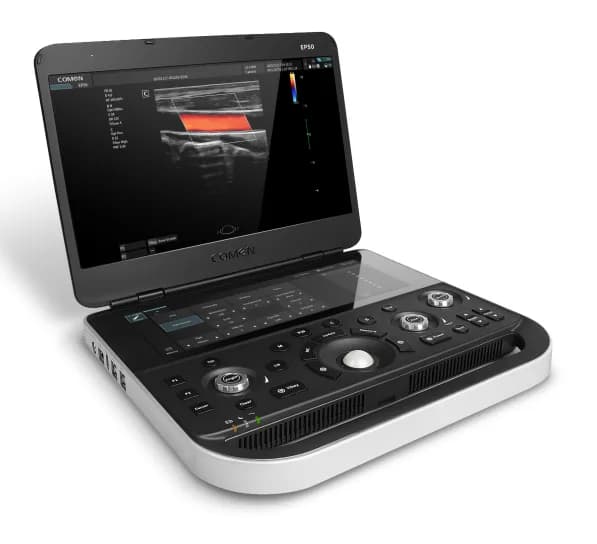 Comen EP50 Series Diagnostic Ultrasound System ultratovush skaneri