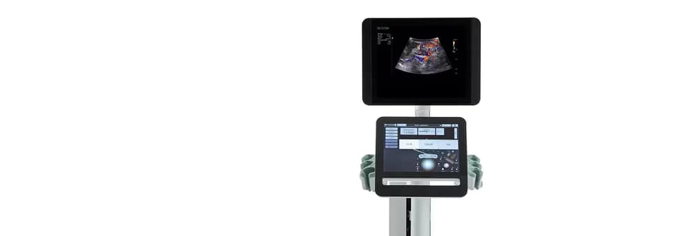bkActiv Ultrasound System for General Surgery & Spine Procedures — Ultratovush tizimi