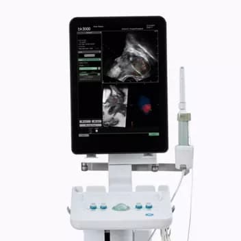 Ultrasound-guided solutions for urology — Ultratovush tizimi