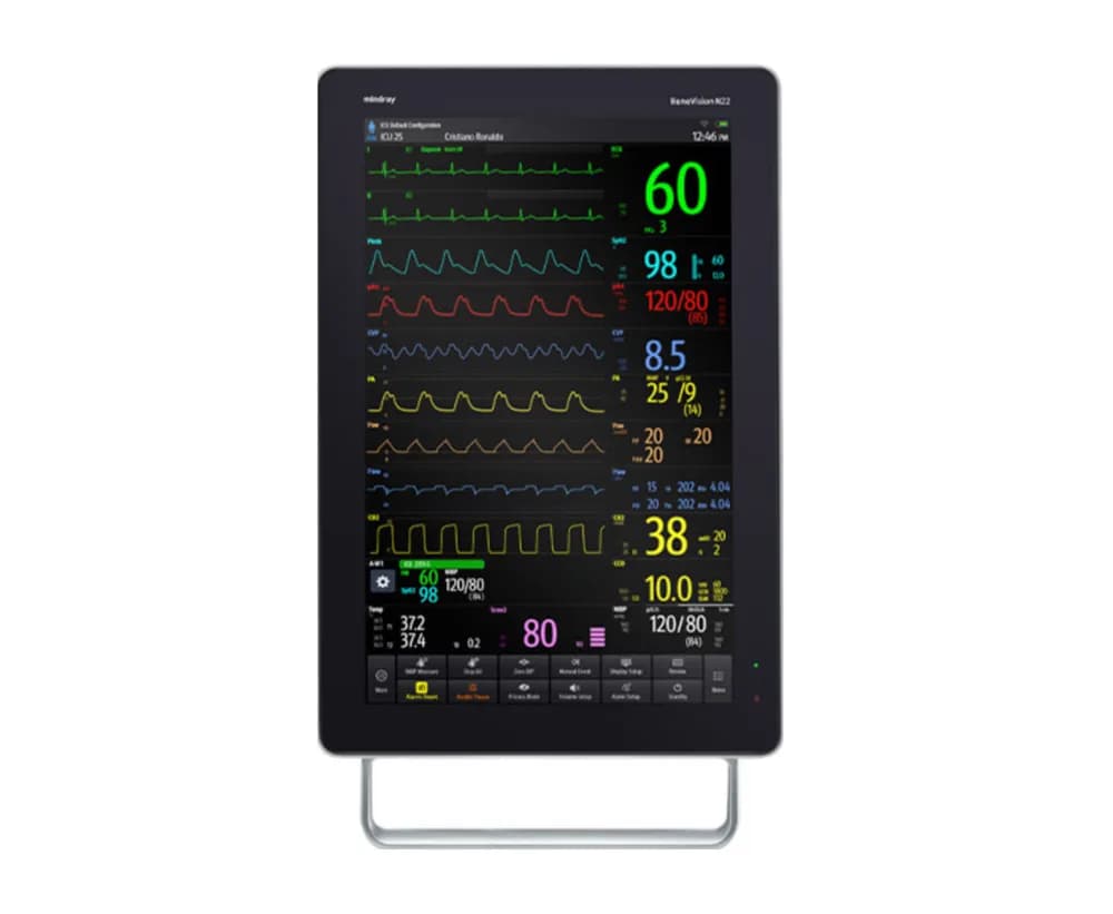 BeneVision N22/N19 — Bemor monitori