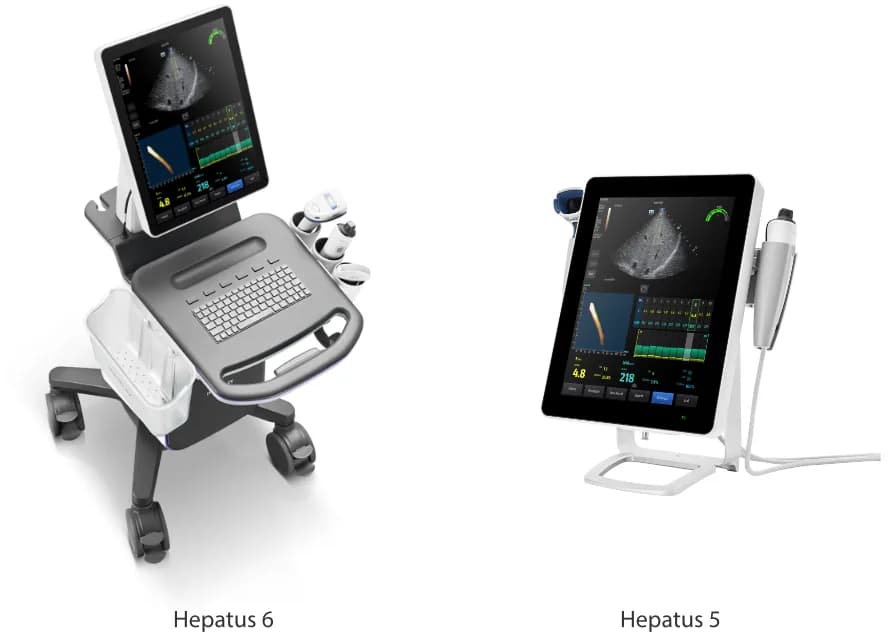 Hepatus Series — Ultratovush tizimi