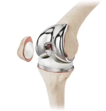 Knee — Ortopediya uskunasi