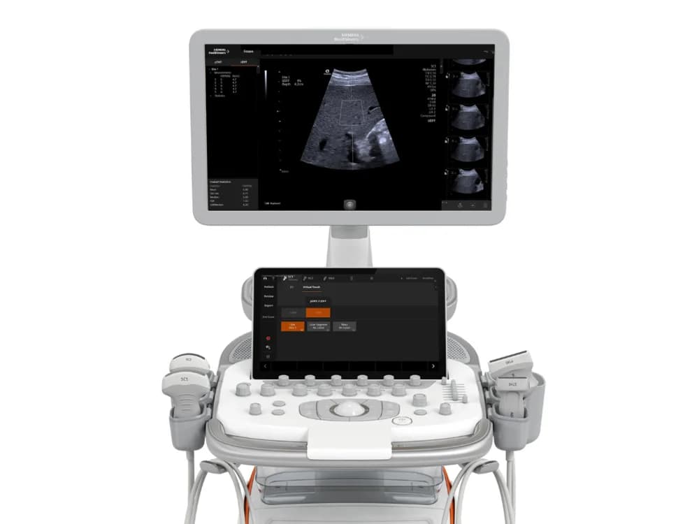 ACUSON Redwood Ultrasound System — Ultratovush tizimi