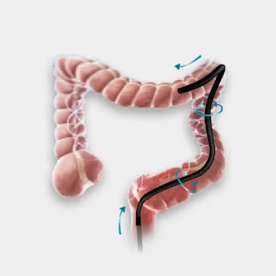 330 SERIES — Gastroenterologik endoskop
