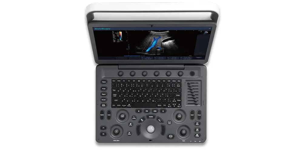 E2 — Portativ ultratovush tizimi