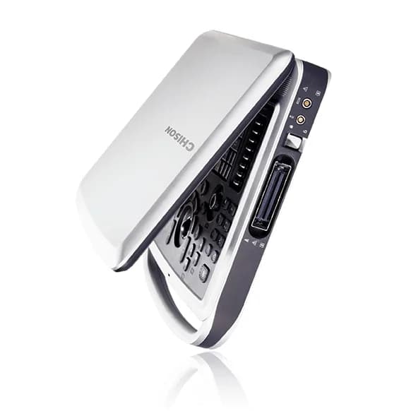 SonoBook 9 — УЗИ-система в формате ноутбука