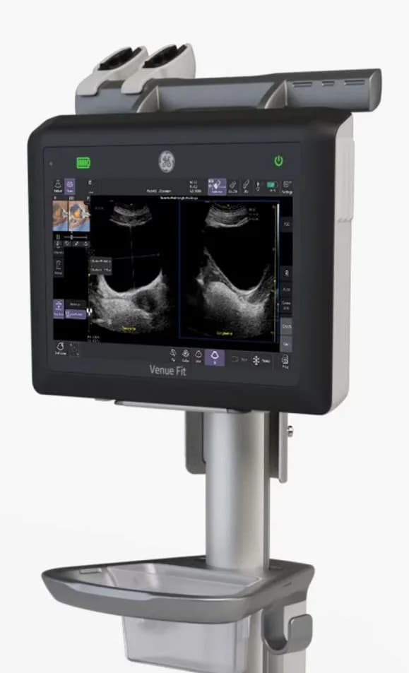 Venue Point of Care Ultrasound for Perioperative Anesthesia — Ультразвуковая система