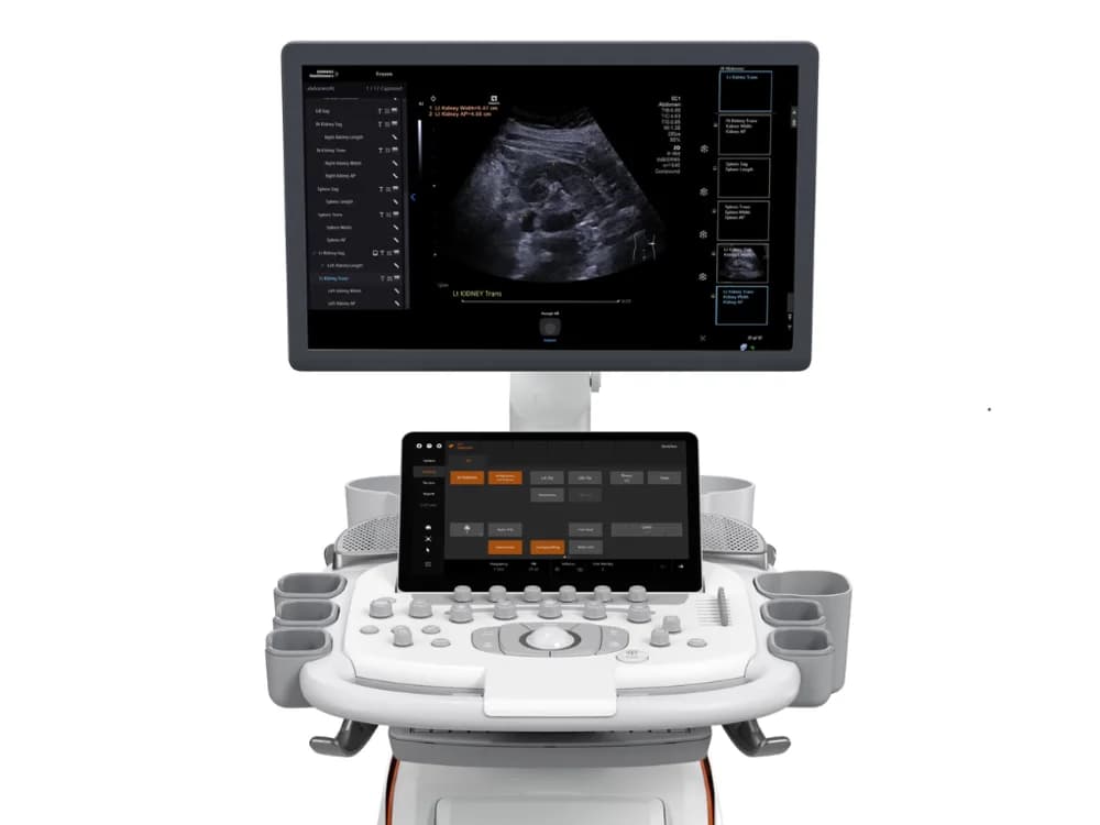ACUSON Sequoia Ultrasound System — Ultratovush tizimi